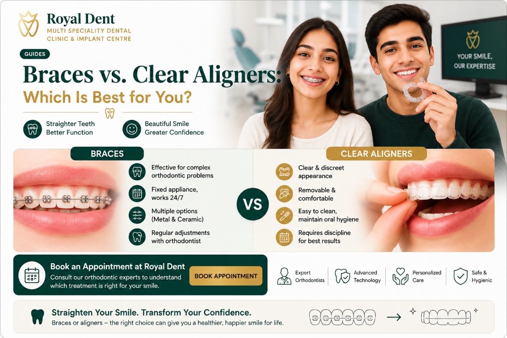 Braces vs Clear Aligners in Vadakara: Which Is Best for You?