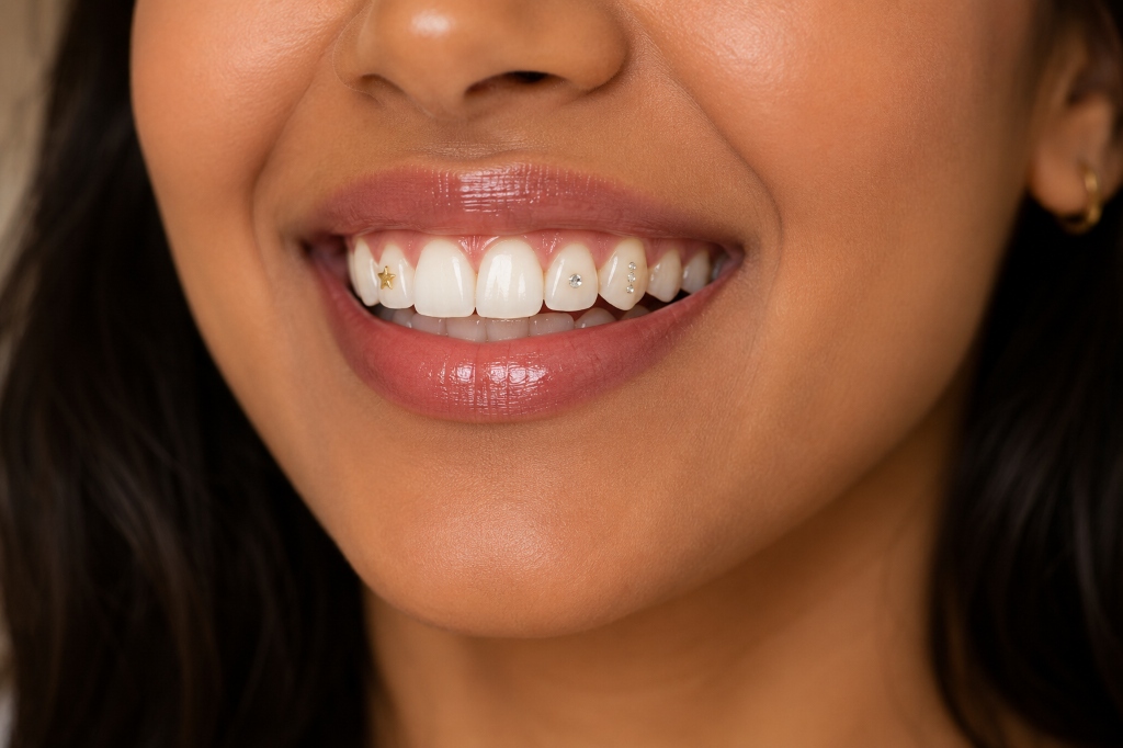 Teeth Jewellery treatment at Royaldent